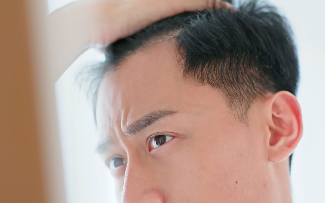Man looking at his hairline with a concerned and worrying expression
